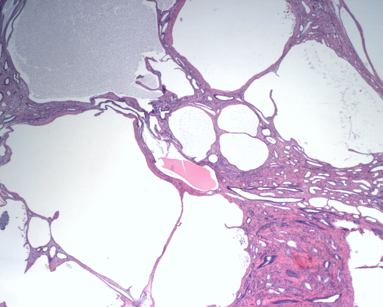 Pathology Image
